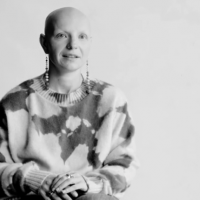 9 Women talk about life after hair loss