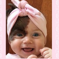 Extensive Skin Surgery For 7th Month Old