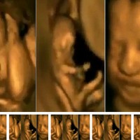 Amazing 4D Ultrasound Baby Video