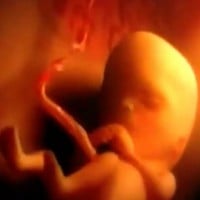MUST WATCH: Life in the womb