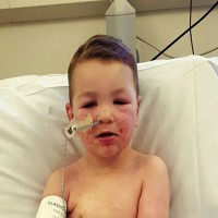 Shocking photos show tot suffering from deadly allergic reaction