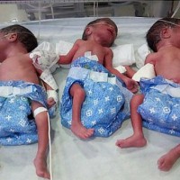 Surprise birth of premature quintuplets
