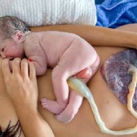 Beautiful Images Of Newborns With Their Lifeline