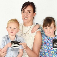 Mum with two sets of reproductive organs conceived in separate wombs