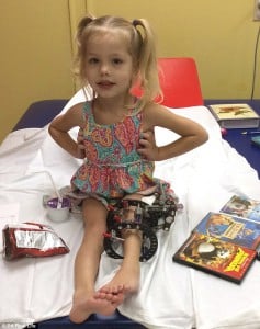 339EAD5900000578-3563606-Brave_Elsie_pictured_had_her_leg_broken_300_times_in_four_months-a-17_1461854358031