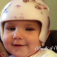 How flat head syndrome affected our baby