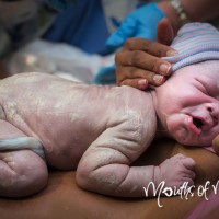 10 beautiful umbilical cord birth photos you HAVE to see