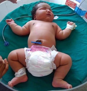 A-newborn-baby-born-weighing-15lbs
