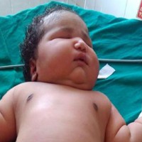 Meet the 'world's heaviest' baby