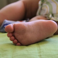 Toddler has sexual organs of a grown man