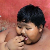 Young boy dubbed the world’s fattest child