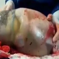 Amazing video captures twin born en-caul