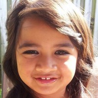 Young girl suffers horrific skin eating disease from common medication