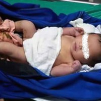 Two-week-old baby girl found in skip bin