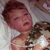 Mum shares how a deadly disease nearly took her sons life