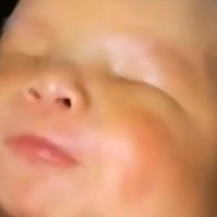 Beautiful baby boy born with no eyes