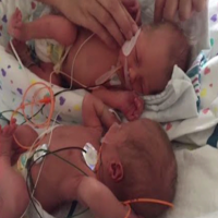Twins born during Hurricane Matthew