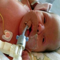 MIRACLE BABY born with more water in her body than blood