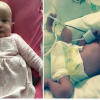 MIRACLE Baby survives after being crushed in womb by seat belt