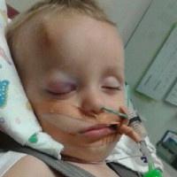 A simple fall left this toddler fighting for his life