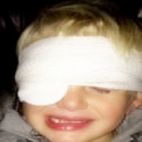 Young boy left traumatised after doctor glued his eye shut
