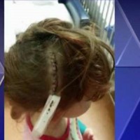 Mum's warning after daughters near fatal shopping centre accident