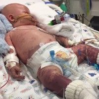 Dad issues stern warning to disease threatening his baby boy's life