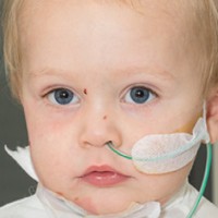 It took just seconds for this toddler's life to be changed forever