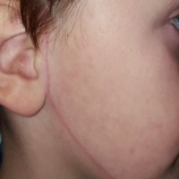 Mums outrage after her son was cut with a knife at childcare