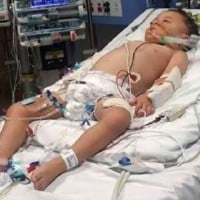 Toddler fighting for life after doctors sent him home