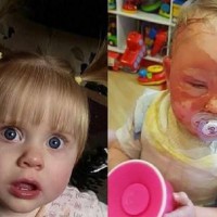 In a split second this toddler was left disfigured for life