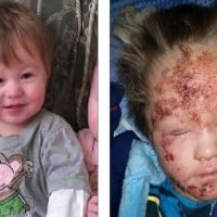 Doctor's reported this dad for refusing treatment