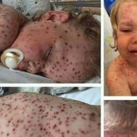 Mum furious as scammers use photo of her son claiming he has cancer