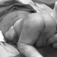 WATCH: Truly amazing caesarean birth caught on film