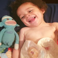 Angered mum tells people there is nothing repulsive about my son