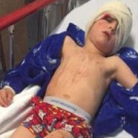 Four year old seriously injured by exploding shower glass