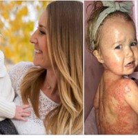 Mother shares heartbreaking photos of her toddler to raise awareness