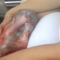 Mum delivers premmie baby in the car!