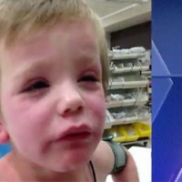 Parents urged to check their kids from head to toe