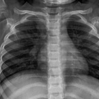 Concerns kids are having too many unnecessary X-rays