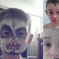 Mother claims popular facepaint 'severely burnt' son's skin