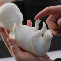 AMAZING 3D Models of Unborn Infants