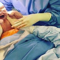 Midwife Pulled Her Own Baby From the Womb