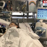 Teen Begs to Die After Nasty Reaction to Sting at Beach