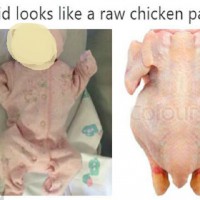 Mum Told Her Baby Looks Like 'A Raw Chicken'