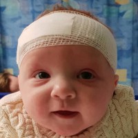 Mum Horrified When Baby’s Birthmark ‘Explodes’