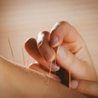 Acupuncture Does NOT Increase Chances of Having a Baby