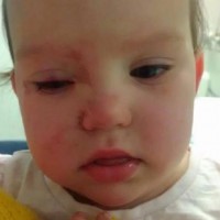 How a Trip to Kmart Nearly Ended in a Toddler Losing Her Eye