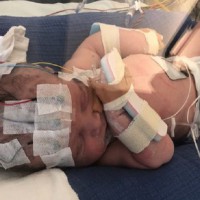 Baby Boy Suffers The Unthinkable Just Hours After Birth