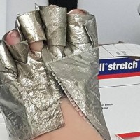 Young Boy Suffers Horrific Burns at the Beach After a Campers Irresponsible Act